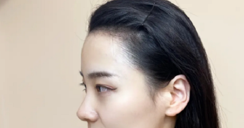 女性額頭寬大發(fā)際線高面相好不好？