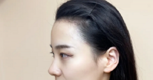 女性額頭寬大發際線高面相好不好？