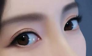 龍鳳眼與陰陽眼的區別